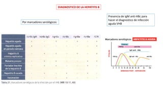 DIAGNOSTICO DE LA HEPATITIS B
Por marcadores serológicos:
Presencia de IgM anti-HBc para
hacer el diagnostico de infección
aguda VHB
 