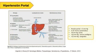 Hipertensión Portal
Argente A, Álvarez M. Semiología Médica. Fisiopatología, Semiotecnia y Propedéutica., 2° Edición. 2013.
• Presión portal: ˂ 5 mm Hg
• 5-10: Forma asintomática
• >8 mm Hg: ascitis
• >10 mm Hg : varices esofágicas
• >12 mm Hg : sangrados
 