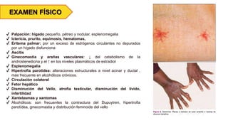 EXAMEN FÍSICO
✔ Palpación: hígado pequeño, pétreo y nodular, esplenomegalia
✔ Ictericia, prurito, equimosis, hematomas,
✔ Eritema palmar: por un exceso de estrógenos circulantes no depurados
por un hígado disfunciona
✔ Ascitis
✔ Ginecomastia y arañas vasculares: ↓ del catabolismo de la
androstenediona y el ↑ en los niveles plasmáticos de estradiol
✔ Esplenomegalia
✔ Hipertrofia parotidea: alteraciones estructurales a nivel acinar y ductal ,
más frecuente en alcohólicos crónicos.
✔ Circulación colateral
✔ Fetor hepático
✔ Disminución del Vello, atrofia testicular, disminución del lívido,
infertilidad
✔ Xantelasmas y xantomas
✔ Alcohólicos: son frecuentes la contractura del Dupuytren, hipertrofia
parotídea, ginecomastia y distribución feminoide del vello
 