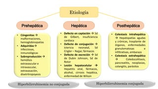 Etiología
Prehepática Hepática Posthepática
• Cóngenitas 
malformaciones,
hemoglobinopatías
• Adquiridas
infecciosas,
inmunológicas
• Sobreproducción 
hemólisis
extravascular e
intravascular,
extravasación,
disetritropoyesis
• Defecto en captación  Sd
de Gilbert, insuficiencia
cardiaca
• Defecto de conjugación 
Ictericia neonatal, Sd
Crigler – Najjar, fármacos
• Defecto de excreción  Sd
de Dubin Johnson, Sd de
Rotor
• Lesión hepatocelular 
Hepatitis viral, fármacos,
alcohol, cirrosis hepática,
enfermedad de Wilson
• Colestasis intrahepática
 Hepatopatías agudas
y crónicas, trasplante de
órganos, enfermedades
granulomatosas e
infiltrativas, embarazo
• Colestasis extrahepática
 Coledocolitiasis,
pancreatitis, neoplasias,
colangitis, parásitos
Hiperbilirrubinemia no conjugada Hiperbilirrubinemia conjugada
 