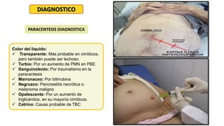 DIAGNOSTICO
PARACENTESIS DIAGNOSTICA
Color del liquido:
 Transparente: Más probable en cirróticos,
pero también puede ser lechoso.
 Turbio: Por un aumento de PMN en PBE
 Sanguinolento: Por traumatismo en la
paracentesis
 Marronaceo: Por bilirrubina
 Negruzco: Pancreatitis necrótica o
melanoma maligno
 Opalescente: Por un aumento de
triglicéridos, en su mayoría cirróticos.
 Cetrino: Causa probable de TBC
 