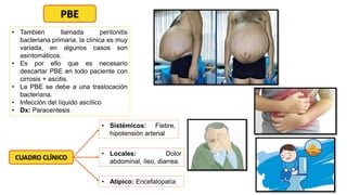 PBE
• También llamada peritonitis
bacteriana primaria, la clínica es muy
variada, en algunos casos son
asintomáticos.
• Es por ello que es necesario
descartar PBE en todo paciente con
cirrosis + ascitis.
• La PBE se debe a una traslocación
bacteriana.
• Infección del líquido ascítico
• Dx: Paracentesis
CUADRO CLÍNICO
• Sistémicos: Fiebre,
hipotensión arterial
• Locales: Dolor
abdominal, íleo, diarrea.
• Atípico: Encefalopatía
 