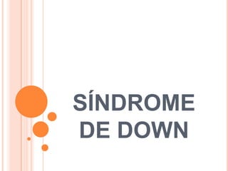 SÍNDROME DE DOWN 