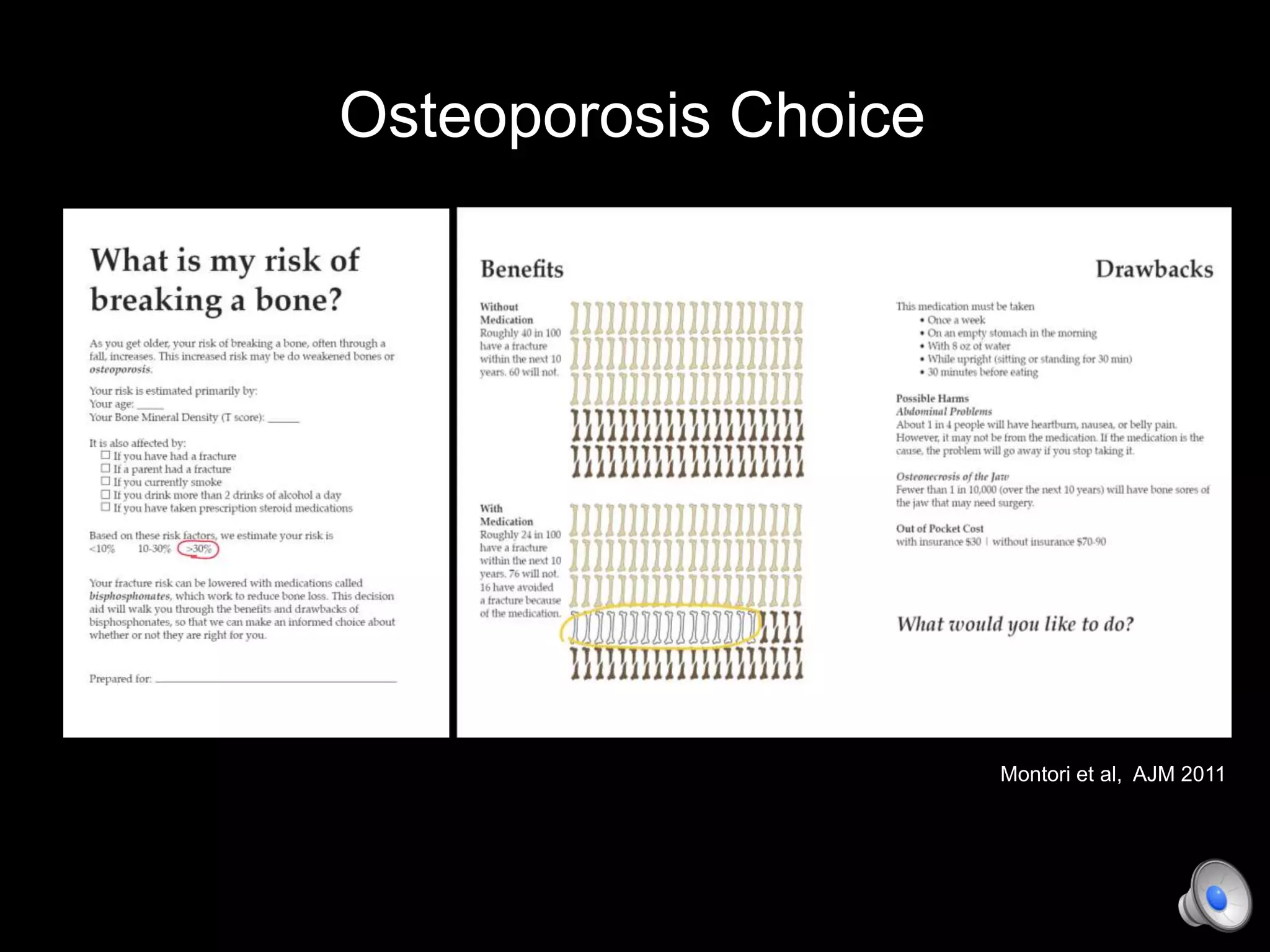 Osteoporosis Choice
Montori et al, AJM 2011
 