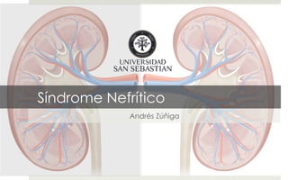 Síndrome Nefrítico
Andrés Zúñiga
 