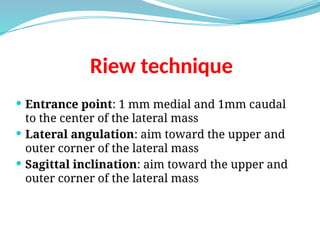 Posterior pedicular spine screws entry points | PPSX