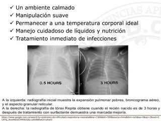  Un ambiente calmado
 Manipulación suave
 Permanecer a una temperatura corporal ideal
 Manejo cuidadoso de líquidos y nutrición
 Tratamiento inmediato de infecciones
https://www.google.com.co/search?q=sindrome+de+dificultad+respiratoria+neonatal&biw=1366&bih=599&source=lnms&tbm=isch&sa=X&sqi=2&ved=0
CAYQ_AUoAWoVChMIi82ij6y-yAIVBWseCh1yKwiO
 