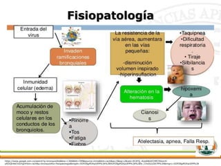 Fisiopatología
https://www.google.com.co/search?q=bronquiolitis&biw=1366&bih=599&source=lnms&tbm=isch&sa=X&sqi=2&ved=0CAYQ_AUoAWoVChMI74bzxrK-
yAIVQh4eCh0zYgil#tbm=isch&q=bronquiolitis+fisiopatologia&imgdii=XDPZBgiM2KpUEM%3A%3BXDPZBgiM2KpUEM%3A%3Bw_CHxSlLbJIA7M%3A&imgrc=XDPZBgiM2KpUEM%3A
 