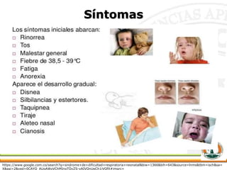 Síntomas
https://www.google.com.co/search?q=sindrome+de+dificultad+respiratoria+neonatal&biw=1366&bih=643&source=lnms&tbm=isch&sa=
X&sqi=2&ved=0CAYQ_AUoAWoVChMInoTQvZS-yAIVQnUeCh1iVQfX#imgrc=_
 