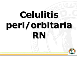 Celulitis
peri/orbitaria
RN
 