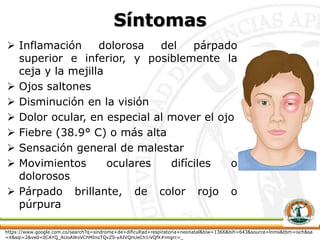 Síntomas
 Inflamación dolorosa del párpado
superior e inferior, y posiblemente la
ceja y la mejilla
 Ojos saltones
 Disminución en la visión
 Dolor ocular, en especial al mover el ojo
 Fiebre (38.9° C) o más alta
 Sensación general de malestar
 Movimientos oculares difíciles o
dolorosos
 Párpado brillante, de color rojo o
púrpura
https://www.google.com.co/search?q=sindrome+de+dificultad+respiratoria+neonatal&biw=1366&bih=643&source=lnms&tbm=isch&sa
=X&sqi=2&ved=0CAYQ_AUoAWoVChMInoTQvZS-yAIVQnUeCh1iVQfX#imgrc=_
 