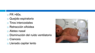  FR >60x.
 Quejido espiratorio
 Tiros intercostales
 Retracción xifoidea
 Aleteo nasal
 Disminución del ruido ventilatorio
 Cianosis
 Llenado capilar lento
 