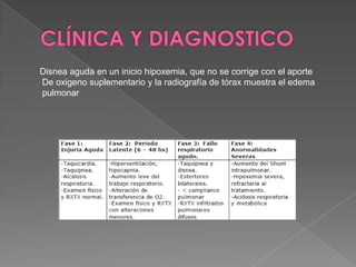Disnea aguda en un inicio hipoxemia, que no se corrige con el aporte
De oxigeno suplementario y la radiografía de tórax muestra el edema
pulmonar
 