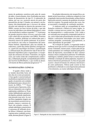 Galhardo FPL & Martinez JAB

mento de gradientes osmóticos pela ação de canais
de sódio, e, possivelmente, cloro, localizados nas membranas de pneumócitos do tipo II. A reabsorção do
edema, por sua vez, ocorreria através de poros dos
pneumócitos do tipo I. Estudos, em animais e em humanos, têm demonstrado que o clearance do edema
alveolar está reduzido na maioria dos pacientes com
SDRA, mesmo em fases iniciais da lesão, o que não
ocorre em indivíduos com edemas hidrostáticos, como
o da insuficiência cardíaca esquerda.(17,18) A presença
de grandes prejuízos desse clearance está asso-ciada
a pior sobrevida em pacientes com SDRA. Proteínas
solúveis, também, poderiam ser reabsorvidas para o
interstício através do epitélio pulmonar. Já as proteínas insolúveis, tais como os componentes das membranas hialinas, dependeriam, para sua retirada, da
endocitose, a partir das células epiteliais e da fagocitose, a partir dos macrófagos alveolares. A proliferação
e a diferenciação dos pneumócitos tipo II são de fundamental importância para a regeneração e a recuperação das estruturas alveolares. Entretanto, em alguns
casos, por razões ainda não completamente conhecidas, a inflamação progride, acompanhada pela infiltração local de miofibroblastos, o que resulta no desenvolvimento de fibrose pulmonar progressiva(1,16).
MANIFESTAÇÕES CLÍNICAS
O quadro clínico tende a
se instalar decorridas horas até
dois dias do evento precipitante.
A fase aguda é caracterizada por
insuficiência respiratória de início
agudo, em paciente com condição
predisponente para o desenvolvimento da SDRA. (1,2,19) Nesse
momento grave hipoxemia, refratária ao tratamento com oxigênio
suplementar, estabelece-se. Os pacientes, habitualmente, queixam-se
de dispnéia, podendo, igualmente,
estar presente tosse seca. Ao exame físico, taquipnéia, tiragem, uso
da musculatura acessória da respiração, cianose e estertores difusos são achados comuns. O
achado radiológico característico
é a presença de infiltrado alveolar difuso e bilateral, com broncograma aéreo, podendo ocorrer,
ainda, derrame pleural. (Figura 3)
252

Os achados laboratoriais são inespecíficos, podendo incluir leucocitose, evidências compatíveis com
coagulação intravascular disseminada, acidose láctica,
hipoxemia arterial e aumento do gradiente alveoloarterial de oxigênio. Na grande maioria das vezes, fazse necessária a instalação de ventilação mecânica.
A síndrome pode ser acompanhada de manifestações sistêmicas e falência de outros órgãos, incluindo o sistema nervoso central, rins, fígado, sistema hematopoiético e cardiovascular. Caso venha a
ser realizada uma tomografia computadorizada de tórax, será evidenciado preenchimento alveolar, consolidação e atelectasias intercaladas com áreas relativamente poupadas, acometendo, principalmente, as
zonas dependentes da gravidade. (1,19)
Na evolução do quadro, a oxigenação tende a
melhorar assim que ocorrer a resolução do edema pulmonar. Entretanto, mesmo assim, a maior parte dos pacientes permanece em ventilação mecânica pela persistência da hipoxemia, necessidade de altos volumes/
minutos e baixa complacência pulmonar. Os infiltrados
radiológicos, também, podem tornar-se menos densos,
refletindo a resolução do edema pulmonar, enquanto as
marcas intersticiais permanecem. É a fase em que pode
ocorrer o desenvolvimento de enfisema intersticial e
de cistos pulmonares. Fibrose pode ocorrer na fase
proliferativa refletindo-se como hipertensão pulmonar
e faveolamento, ao exame radiológico de tórax.

Figura 3 - Radiografia de tórax representativa da SDRA.

 