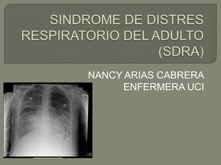 SINDROME DE DISTRES RESPIRATORIO DEL ADULTO (SDRA) NANCY ARIAS CABRERA ENFERMERA UCI 