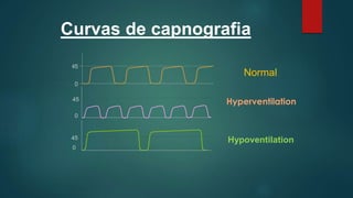 Curvas de capnografia
45
45
0
0
Hypoventilation
Normal
Hyperventilation
 
