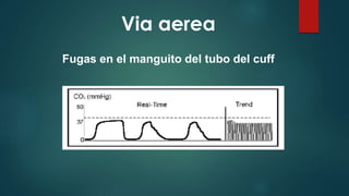 Via aerea
Fugas en el manguito del tubo del cuff
 