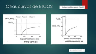 Otras curvas de ETCO2
 