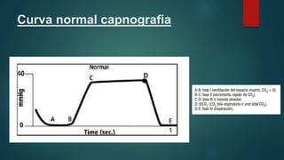 Curva normal capnografia
 