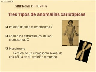 Perdida de todo el cromosoma X Anomalías estructurales  de los cromosomas X Mosaicismo  Pérdida de un cromosoma sexual de una célula en el  embrión temprano 
