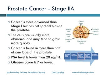Stages of Prostate Cancer
