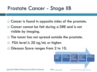 Stages of Prostate Cancer