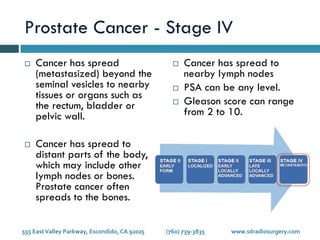 Stages of Prostate Cancer