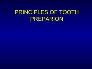 PRINCIPLES OF TOOTH
     PREPARION
 