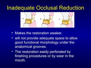 Inadequate Occlusal Reduction



 • Makes the restoration weaker.
 • will not provide adequate space to allow
   good functional morphology under the
   anatomical grooves.
 • The restoration easily perforated by
   finishing procedures or by wear in the
   mouth.
 