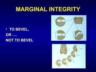 MARGINAL INTEGRITY


• TO BEVEL,
OR ….
NOT TO BEVEL
 