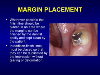 MARGIN PLACEMENT
• Whenever possible the
  finish line should be
  placed in an area where
  the margins can be
  finished by the dentist
  easily and kept clean by
  the patient.
• In addition,finish lines
  must be placed so that
  they can be duplicated by
  the impression without
  tearing or deformation.
 