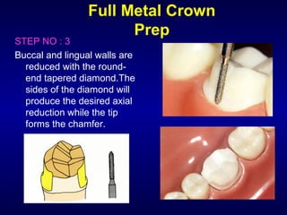 Full Metal Crown
                       Prep
STEP NO : 3
Buccal and lingual walls are
  reduced with the round-
  end tapered diamond.The
  sides of the diamond will
  produce the desired axial
  reduction while the tip
  forms the chamfer.
 
