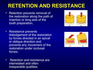 RETENTION AND RESISTANCE
• Retention prevents removal of
  the restoration along the path of
  insertion or long axis of the
  tooth preparation.

• Resistance prevents
  dislodgement of the restoration
  by forces directed in an apical
  or oblique direction and
  prevents any movement of the
  restoration under occlusal
  forces.

•    Retention and resistance are
    interrelated and often
    inseparable qualities.
 