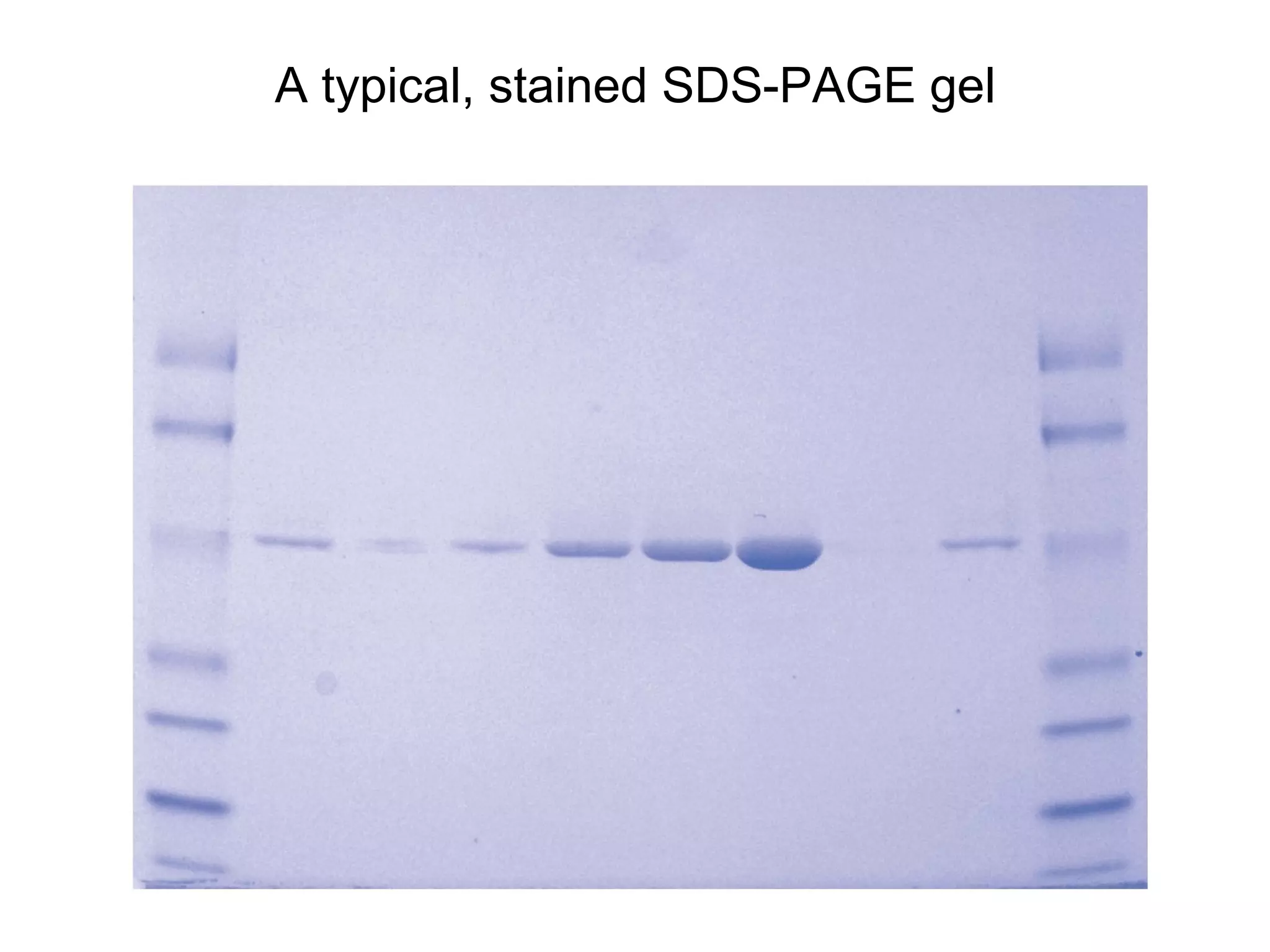 A typical, stained SDS-PAGE gel 
 