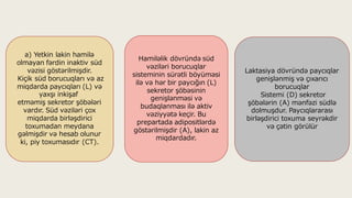 a) Yetkin lakin hamilə
olmayan fərdin inaktiv süd
vəzisi göstərilmişdir.
Kiçik süd borucuqları və az
miqdarda paycıqları (L) və
yaxşı inkişaf
etməmiş sekretor şöbələri
vardır. Süd vəziləri çox
miqdarda birləşdirici
toxumadan meydana
gəlmişdir və hesab olunur
ki, piy toxumasıdır (CT).
Laktasiya dövründə paycıqlar
genişlənmiş və çıxarıcı
borucuqlar
Sistemi (D) sekretor
şöbələrin (A) mənfəzi südlə
dolmuşdur. Paycıqlararası
birləşdirici toxuma seyrəkdir
və çətin görülür
Hamiləlik dövründə süd
vəziləri borucuqlar
sisteminin sürətli böyüməsi
ilə və hər bir paycığın (L)
sekretor şöbəsinin
genişlənməsi və
budaqlanması ilə aktiv
vəziyyətə keçir. Bu
prepartada adipositlərdə
göstərilmişdir (A), lakin az
miqdardadır.
 