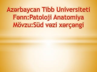 Azərbaycan Tibb Universiteti
Fənn:Patoloji Anatomiya
Mövzu:Süd vəzi xərçəngi
 