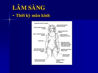 LAÂM SAØNG
- Thôøi kyø maõn kinh
 