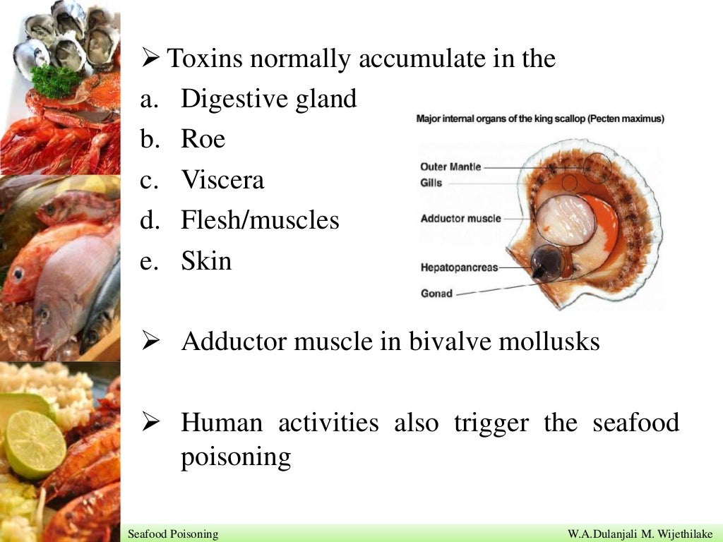 Seafood poisoning by Dulanjali M. Wijethilake