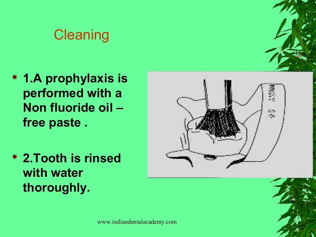 Sealants & preventive resin restorations / dental courses