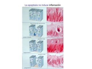 La apoptosis no induce  inflamaci ón 