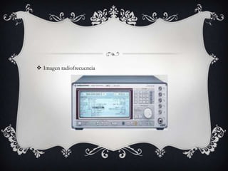 Imagen radiofrecuencia