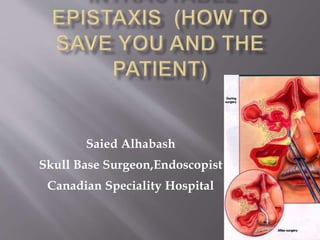 Saied Alhabash
Skull Base Surgeon,Endoscopist
Canadian Speciality Hospital
 
