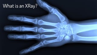 Copyright © 2021ADP, Inc.
What is an XRay?
 