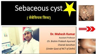 Sebaceous cyst
[ सेबेससयस ससस्ट]
17-09-2020Sebaceous cyst- Dr Mahesh Kumar 1
 
