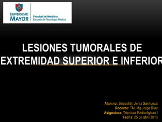 Alumno: Sebastián Jerez Sanhueza
Docente: TM. Mg Jorge Díaz
Asignatura: Técnicas Radiológicas I
Fecha: 25 de abril 2013
LESIONES TUMORALES DE
EXTREMIDAD SUPERIOR E INFERIOR
 