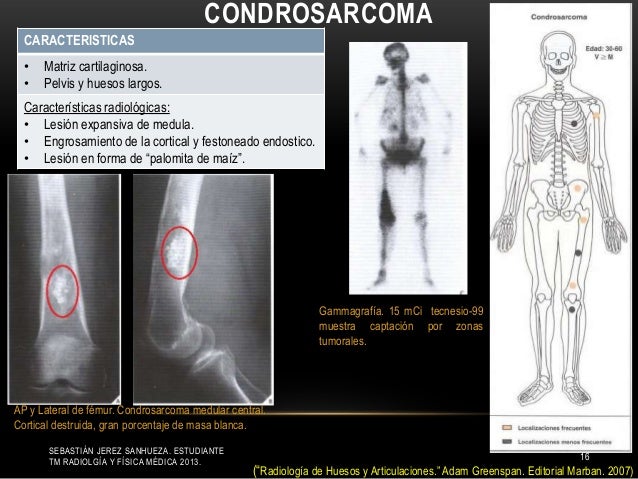 lesiones tumorales de extremidad superior e inferior