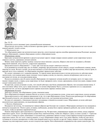 Рис. 22, 23
Громадные услуги оказывает шаль душевнобольным женщинам.
Шали вполне достаточно, чтобы остановить приливы крови к голове; это достигается также обертыванием ног или теплой
ножной ванной с золой и солью.
4. Обертывание ног
Это обертывание важно как вспомогательное средство, сопутствующее другим способам применения воды Различают два рода
ножных обертываний, а именно обертывание ступни и обертывание колен.
Обертывание ступни
Крестьяне за недостатком времени и средств поступают просто: поверх мокрых носков одевают сухие шерстяные чулки и
ложатся в постель, укрывшись теплым одеялом.
Можно также намочить грубые льняные лоскутья в воде пополам с уксусом, обернуть ими ноги по лодыжки и, обложив
шерстяной повязкой, лечь в постель, старательно укрывшись.
Продолжительность обертывания 1—2 часа; при этом всегда следует ложиться в постель.
Если развивается сильный жар, как это бывает, например, при воспалении легких живота, следует возобновлять повязку, вновь
намочив ее в воде. Во всех случаях, когда надо вытянуть из ноги болезненные соки, ослабить жар при воспалении, отвлечь кровь из
верхней части тела в нижнюю, это обертывание оказывает превосходное действие.
Не следует смешивать его с ножными ваннами. Те гораздо менее продолжительны и потому результаты их действия менее
значительны; хотя ножная ванна также отвлекает тепло и кровь к ногам, но очистить, извлечь испорченные соки из ног не в
состоянии ни теплая, ни холодная ножная ванна.
Нельзя не упомянуть еще об одном способе обертывания: кто переносит лечение водой и по вечерам, пусть тот перед сном
наденет мокрые носки, а сверху сухие шерстяные; он будет прекрасно спать; только, проснувшись ночью или утром, мокрые носки
следует немедленно скинуть.
На крестьян, сильно устающих за день, этот способ действует еще более освежающим образом, чем холодная ножная ванна. У
кого постоянно зябнут ноги, пусть также испытает это ночное обертывание Часто с успехом я применял его и к страдающим
потливостью ног, но после предварительного приема нескольких паровых ножных ванн.
Обертывание до колен
Действует сильнее, чем обертывание ступни, описанное выше
Ноги обертываются мокрым льняным бинтом до колен и плотно укутываются сухим, лучше всего шерстяным, куском материи.
Продолжительность и все правила применения те же, что и при обертывании ступни. Решительно рекомендую это обертывание
при большой усталости, для удаления жара из верхней части тела, для удаления желудочных газов.
Не надо его смешивать с описанным в разделе «полуванны» стоянием на коленях в воде. Обертывание до колен действует
исключительно укрепляющим, а не выделяющим образом.
5. Нижнее обертывание
Называется так потому, что назначается главным образом при болезнях ног и живота. Обертывание начинается под мышками и
кончается пальцами ног. Плечи и руки, оставаясь свободными, должны быть хорошо прикрыты рубахой, еще лучше чем-нибудь
потеплее, чтобы не проникал наружный воздух.
Нижнее обертывание приготавливается и применяется так. На простыню, покрывающую матрац или сенник, кладут широкое
шерстяное одеяло. Холст для обертывания должен быть такой величины, чтобы мог обернуть 2 раза, а в иных случаях 3—4 раза все
тело и ноги. Сложив его вдвое, намачивают в холодной воде, выжимают крепко и кладут в виде прямоугольника на разложенное
шерстяное одеяло. На этот холст ложится пациент, и холст оборачивают вокруг всего тела таким образом, чтобы ни одно место
туловища не осталось непокрытым и чтобы один мокрый конец холста заходил за другой. Сверху мокрого холста обертывается
лежащее под ним шерстяное одеяло, на него кладется еще перина. Ноги обыкновенно покрываются еще одним одеялом (рис. 24).
 