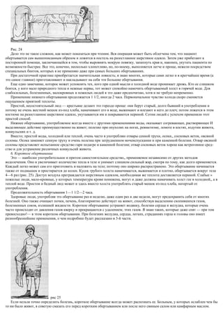 Рис. 24
Дело это не такое сложное, как может показаться при чтении. Вся операция может быть облегчена тем, что пациент
обертывается сам вышеописанным образом и ложится в постель на разостланное шерстяное одеяло. Затем уже прибегают к
посторонней помощи, заключающейся в том, чтобы выровнять мокрую повязку, запахнуть края и, наконец, укутать пациента по
возможности быстрее. Все это, конечно, несколько хлопотливо, но, по-моему, выполняется легче и проще, нежели посредством
специальных бинтов, которых я не применяю даже при самых больших обертываниях.
При достаточной практике приобретается значительная ловкость; я знаю многих, которые сами легко и в кратчайшее время (а
это самое главное) приготавливают и накладывают на себя эти большие обертывания.
Еще одно замечание, которое может успокоить тех, кого при одной мысли о холодной воде пронимает дрожь. Кто ее слишком
боится, у кого мало природного тепла и нежные нервы, тот может спокойно намочить обертываемый холст в горячей воде. Для
слабосильных, болезненных, малокровных и пожилых людей я это даже предпочитаю, хотя и не требую непременно.
Применение нижнего обертывания продолжается 1 1/2, иногда 2 часа. Первоначальное чувство холода скоро сменяется
ощущением приятной теплоты.
Простой, несостоятельный люд — крестьяне делают это гораздо проще: они берут старый, долго бывший в употреблении и
потому не очень жесткий мешок из-под хлеба, намачивают его в воде, выжимают и влезают в него до плеч; потом ложатся в этом
костюме на разостланное шерстяное одеяло, укутываются им и покрываются периной. Сотни людей с успехом применяли этот
простой способ.
Нижнее обертывание, употребляемое всегда вместе с другими применениями воды, оказывает согревающее, растворяющее И
выделяющее действие преимущественно на живот; полезно при опухолях на ногах, ревматизме, ломоте в костях, вздутии живота,
конвульсиях и т. д.
Вместо; простой воды, холодной или теплой, очень часто я употребляю отвары сенной трухи, осоки,, сосновых веток, овсяной
соломы. Осока заменяет сенную труху и очень полезна при затрудненном мочеиспускании и при каменной болезни. Отвар овсяной
соломы представляет испытанное средство гари подагре и каменной болезни; отвар сосновых веток хорош как ветрогонное сред-
ство и для устранение различных конвульсий живота.
6. Короткое обертывание
Это — наиболее употребительное и притом самостоятельное средство,, применяемое независимо от других методов
водолечения. Оно и увеличивает количество тепла в теле и унимает слишком сильный жар, смотря по тому, как долго применяется.
Каждый легко может сам его приготовить и наложить на тело; поэтому оно широко распространено. Это обертывание начинается
также от подмышек и простирается до колен. Кусок грубого холста намачивается, выжимается и плотно, обертывается вокруг тела
4—6 раз (рис. 25). Доступ воздуха преграждается шерстяным одеялом, необходимая же теплота доставляется периной. Слабые »
пожилые люди, мало-кровные, у которых температура крови понижена, могут и даже должны намачивать холст гее в холодной,, а в
теплой воде. Простои и бедный люд может и здесь вместо холста употреблять старый мешок из-под хлеба, натертый от
употребления.
Продолжительность обертывания 1—1 1/2—2 часа.
Здоровые люди, употребляя это обертывание раз в неделю, даже один раз в две недели, могут предохранить себя от многих
болезней. Оно также очищает почки, печень, благоприятно действует на живот, способствуя выделению скопившихся газов,
болезненных соков, излишней жидкости. Короткое обертывание устраняет водянку, болезни сердца и желудка, которые очень
часто происходят от давления газов кверху и прекращаются с удалением; этих газов. Я знаю таких, которые даже спят — при том
превосходно!— в этом коротком обертывании. При болезнях желудка, сердца, легких, страданиях горла и головы оно имеет
разнообразнейшие применения, о чем подробнее будет рассказано в 3-й части.
рис 25
Если нельзя точно определить болезнь, короткое обертывание всегда может распознать ее. Больным, у которых ослаблен чем бы
то ни было живот, я советую смазать его перед коротким обертыванием или после него свиным салом или камфарным маслом.
 