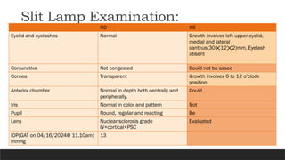 Slit Lamp Examination:
OD OS
Eyelid and eyelashes Normal Growth involves left upper eyelid,
medial and lateral
canthus(30 12 2)mm, Eyelash
⨉ ⨉
absent
Conjunctiva Not congested Could not be assed
Cornea Transparent Growth involves 6 to 12 o’clock
position
Anterior chamber Normal in depth both centrally and
peripherally.
Could
Iris Normal in color and pattern Not
Pupil Round, regular and reacting Be
Lens Nuclear sclerosis grade
IV+cortical+PSC
Evaluated
IOP(GAT on 04/16/2024@ 11.10am)
mmHg
13
 