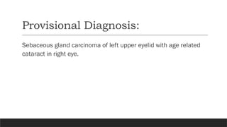 Provisional Diagnosis:
Sebaceous gland carcinoma of left upper eyelid with age related
cataract in right eye.
 